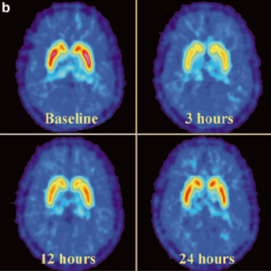 CNS-Drug-Development-300x300